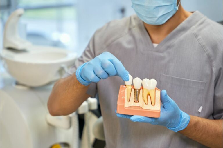 How Long Do Dental Implants Last? (Tips to Last Longer)