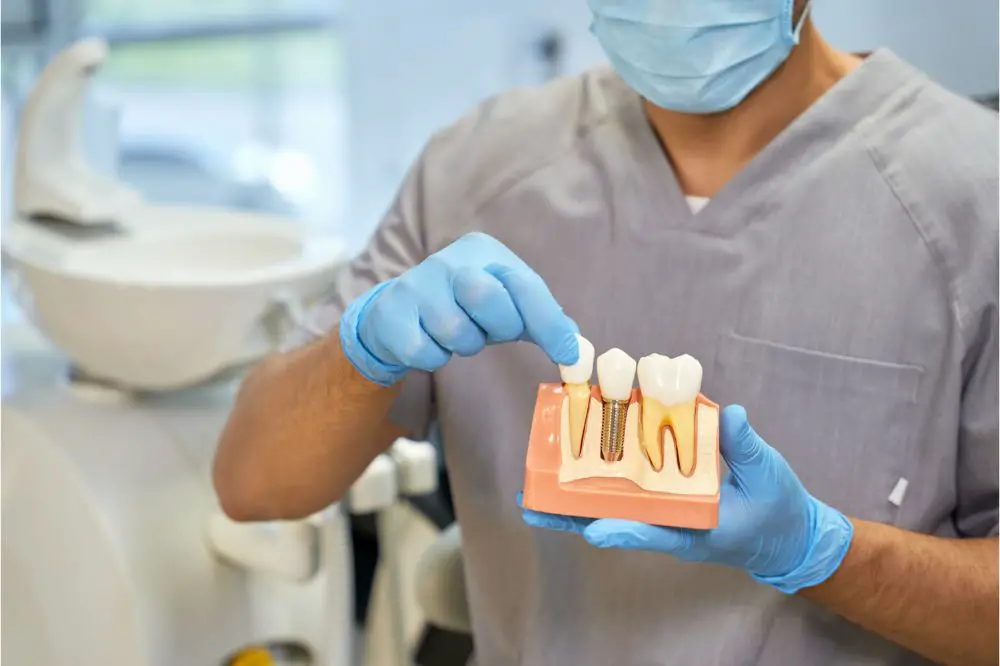 How Long Do Dental Implants Last