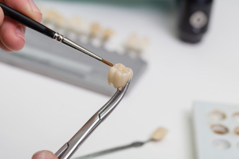 How Much Do Dental Crowns Cost? (Your Ultimate Guide)