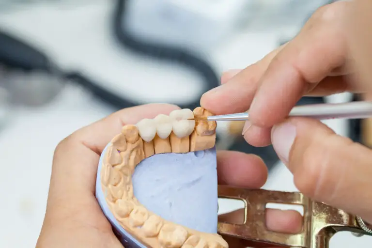 How Much Does a Dental Bridge Cost Without Insurance?