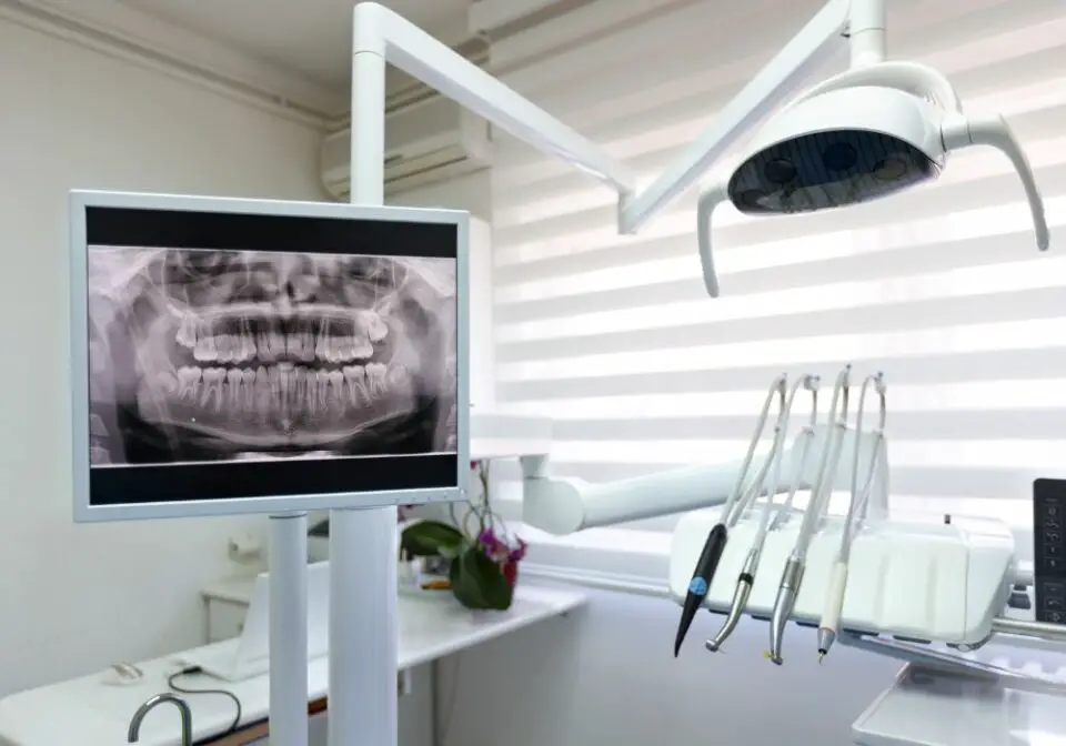 How Many Dental Xrays Are Safe In A Year? (Ultimate Guide)