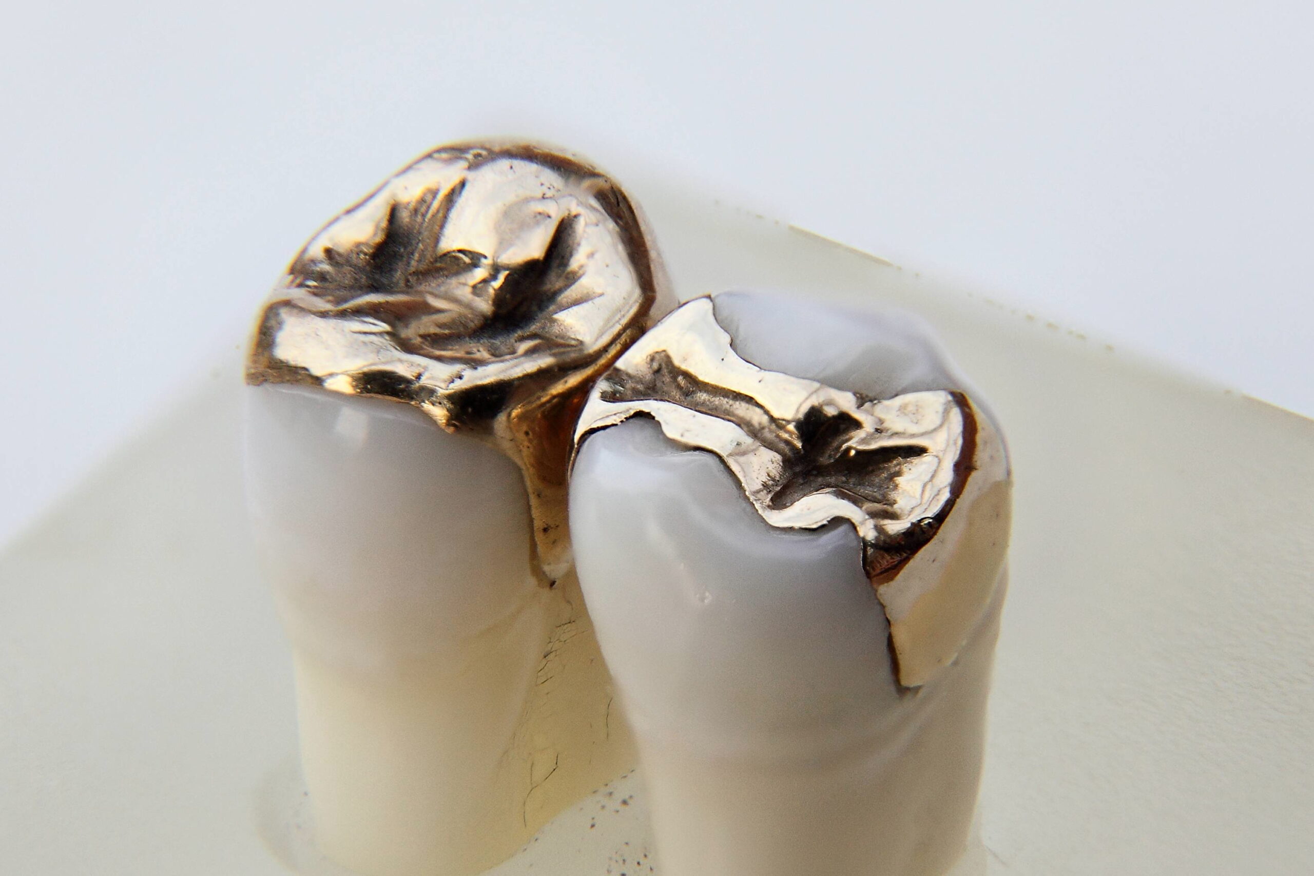 How much do dental gold crowns cost