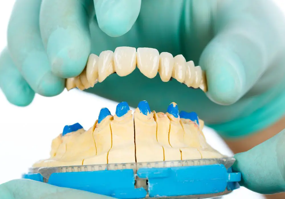 Types of Dental Bridges