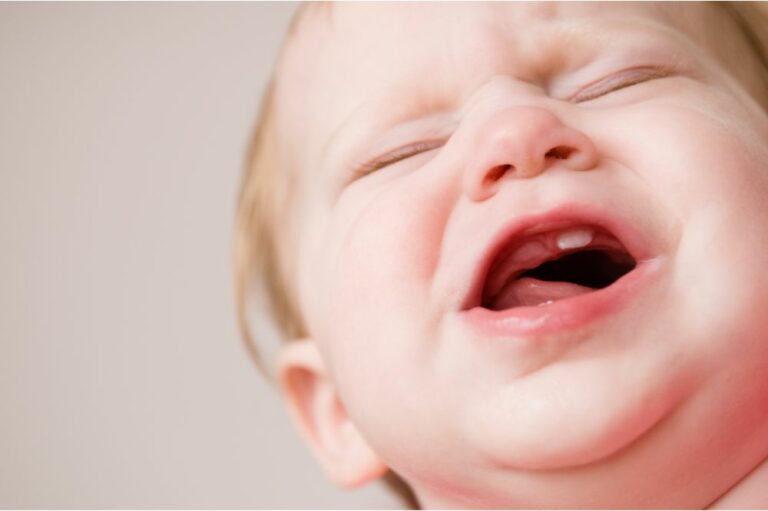 What if Baby Gets Upper Teeth First?