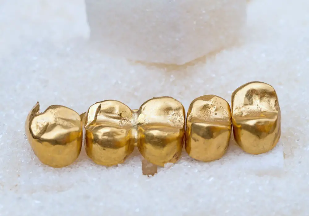 What types of dental gold are there