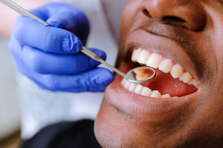 Who Qualifies For VA Dental Care? (Ultimate Guide)