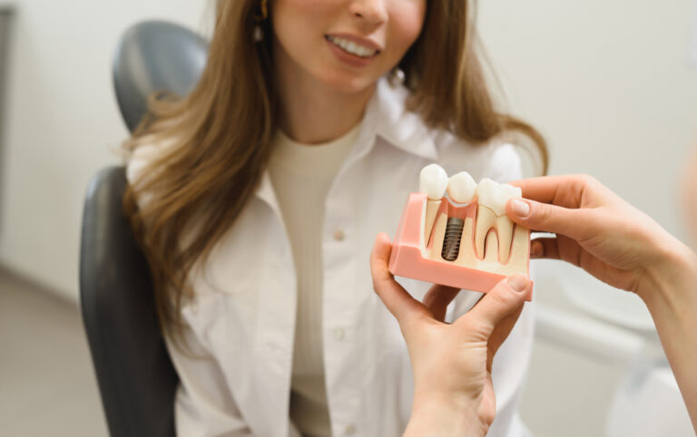 How Long Does It Take To Get Dental Implants? (With Procdure)