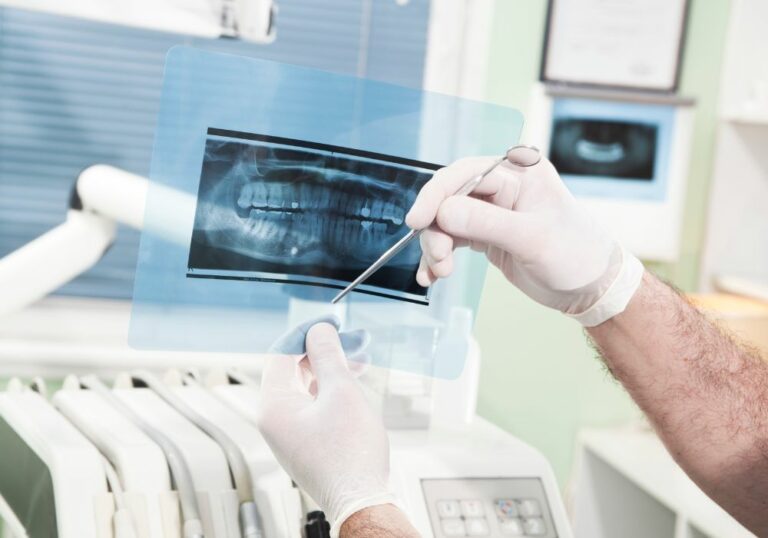 How Much Does Dental XRay Costs? (By Types)