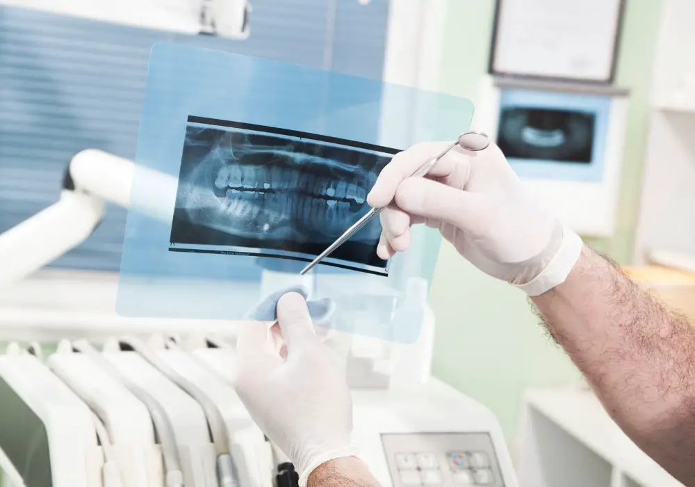 Extraoral X-Rays