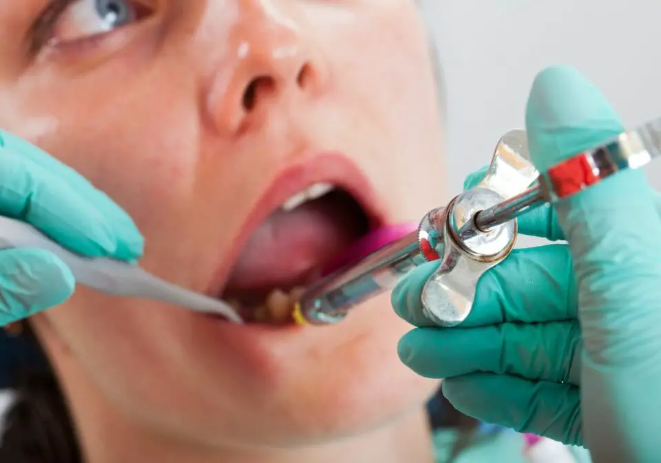 What Is Local Anesthesia Dental? Uses & Side Effects)