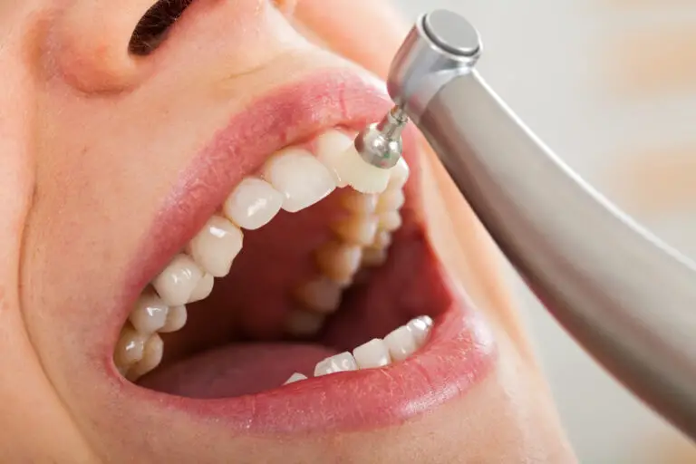 How Long After Dental Cleaning Can I Eat? (With Considered Tips)