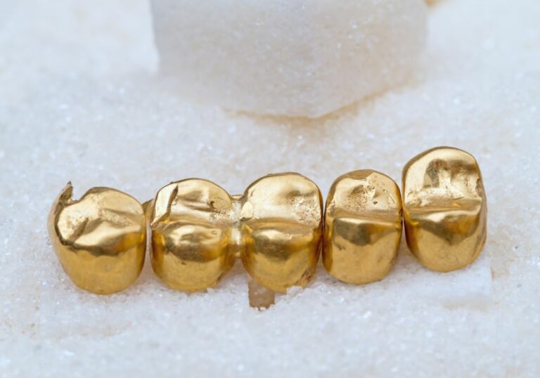 How Much Is Dental Gold Worth? (Evaluation Guide)