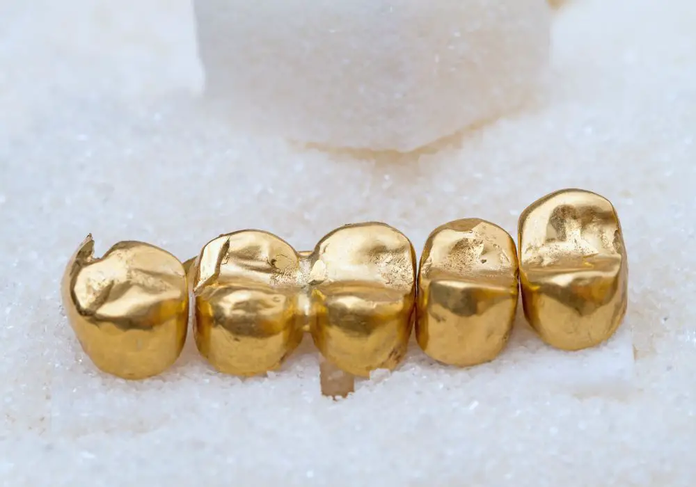 How Much is a Set of Gold Teeth Worth