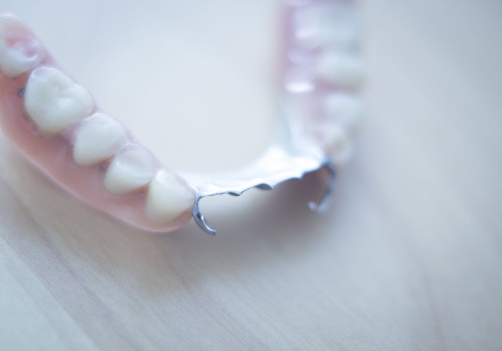 How long do partial dentures last