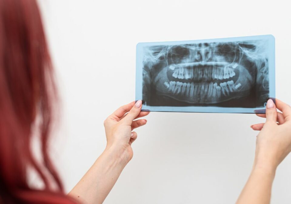 How To Stop Dental Bone Loss? (Causes & Treatments)