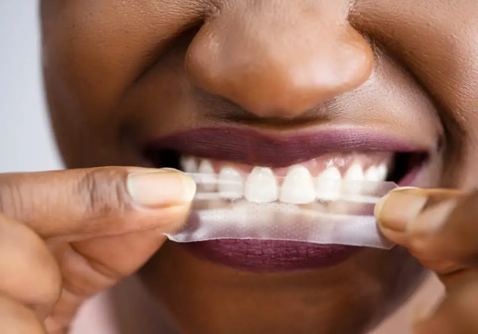 Why Do My Teeth Hurt After Whitening Strips? (Causes & Prevention)