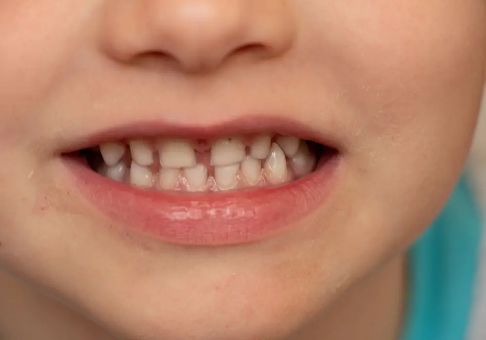 Tips for When Baby Teeth Start Falling Out