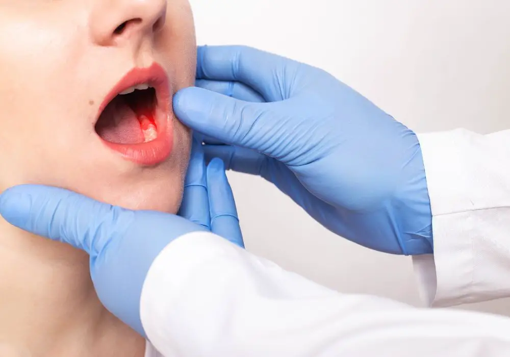 What Causes a Dental Abscess