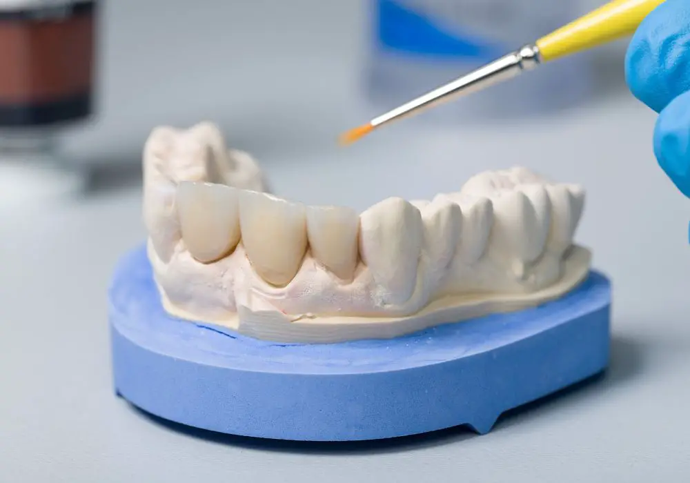 What Does a Dental Crown or Onlay Cost