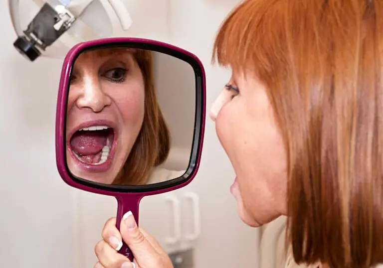 How Long After Dental Implants Can I Eat Normally? (Ultimate Guide)