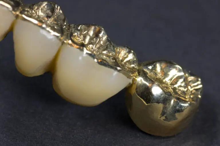 What Karat Is Dental Gold? (Real Worth Vs. Value)