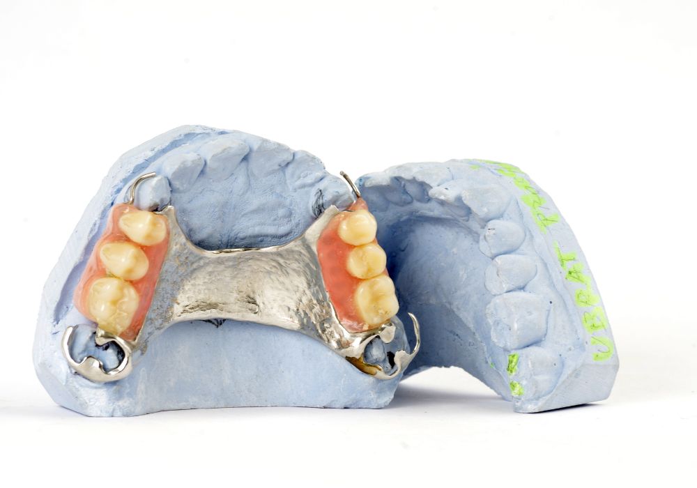 What are Partial Dentures & Why Do You Need One