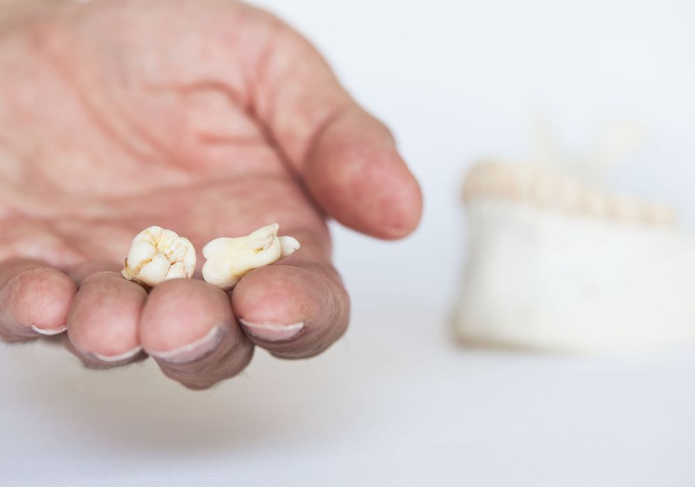 What are the First Signs of Wisdom Teeth Coming in?