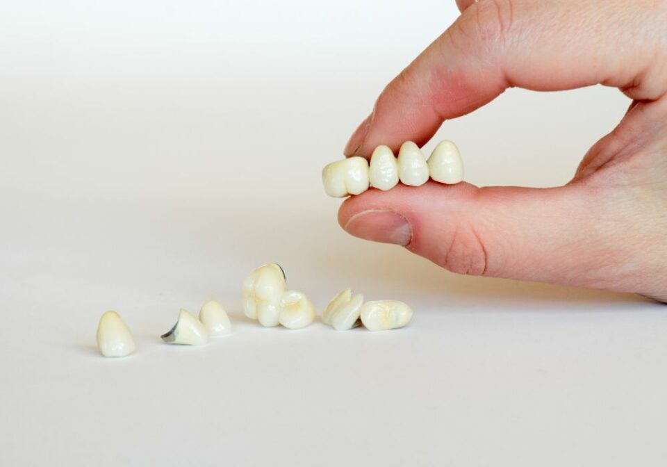 High-Quality How Long After Crown Can I Eat Design Concept High-Quality How Long After Crown Can I Eat Design Concept