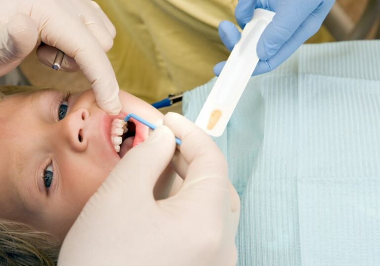 When Can I Brush My Teeth After Fluoride Treatment? (Aftercare Guide)