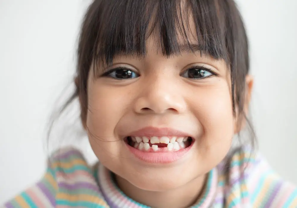 When Do Children First Begin Losing Teeth?