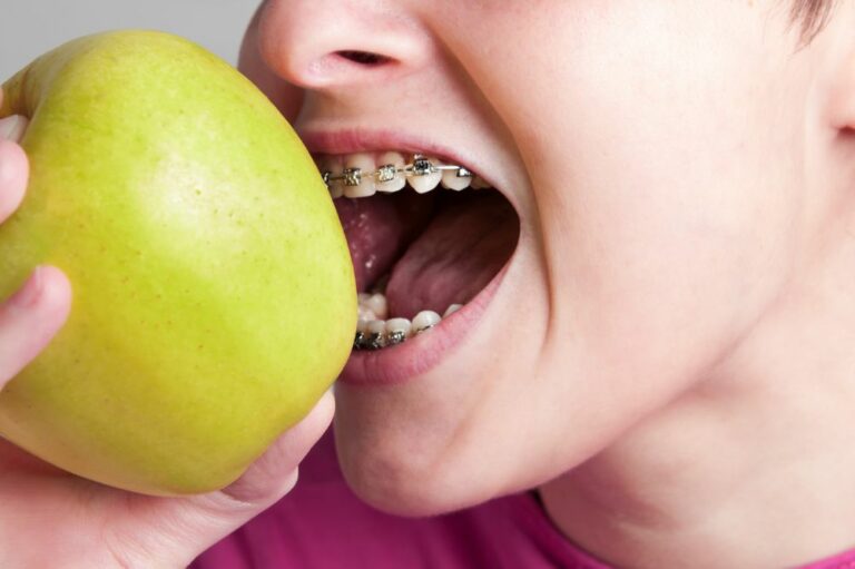 Why Do My Teeth Hurt When I Eat? (14 Reasons)