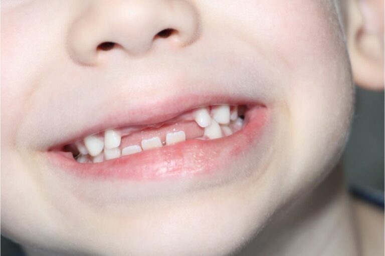 5 Reasons Why We Have Milk Teeth