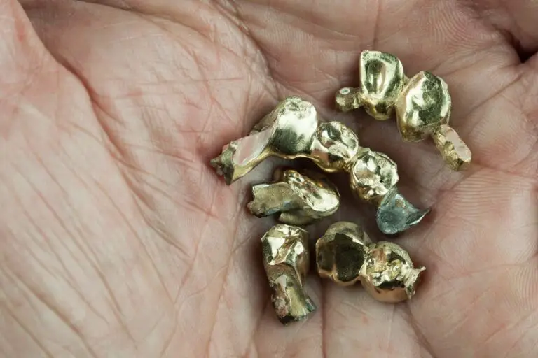 How Much Is Dental Gold Worth? (Evaluation Guide)
