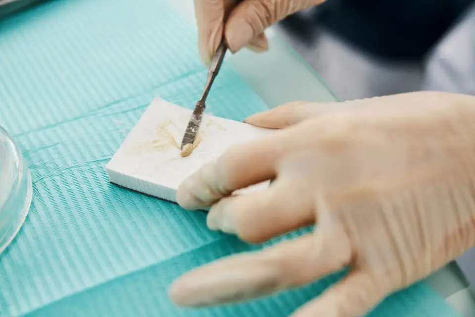 How Long After Dental Cleaning Can I Eat With Considered Tips how-long-after-dental-cleaning-can-i-eat-with-considered-tips
