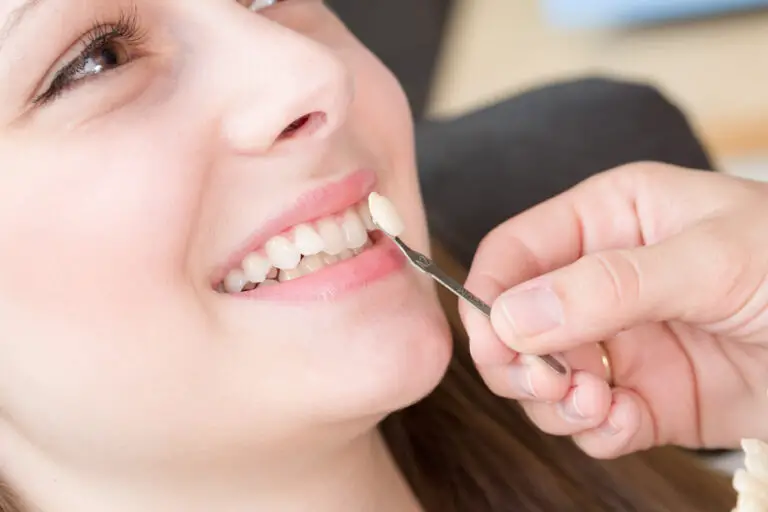 How Much Do Dental Veneers Cost? (Types & Alternatives)