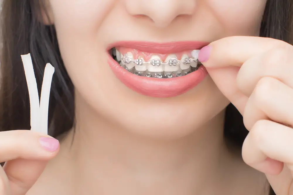 How To Use Dental Wax (A Guide To Applying And Using It）
