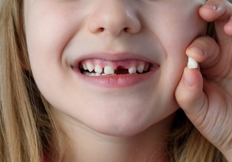 When Do Kids Get Adult Teeth? (All You Need to Know)