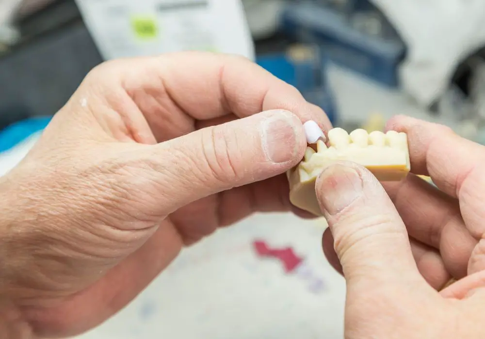 3D Printed Dental Prosthetics