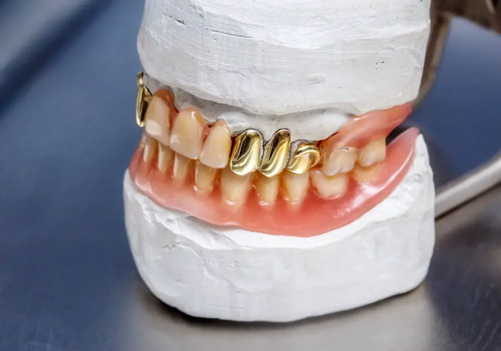 Alternative Uses for Gold Teeth