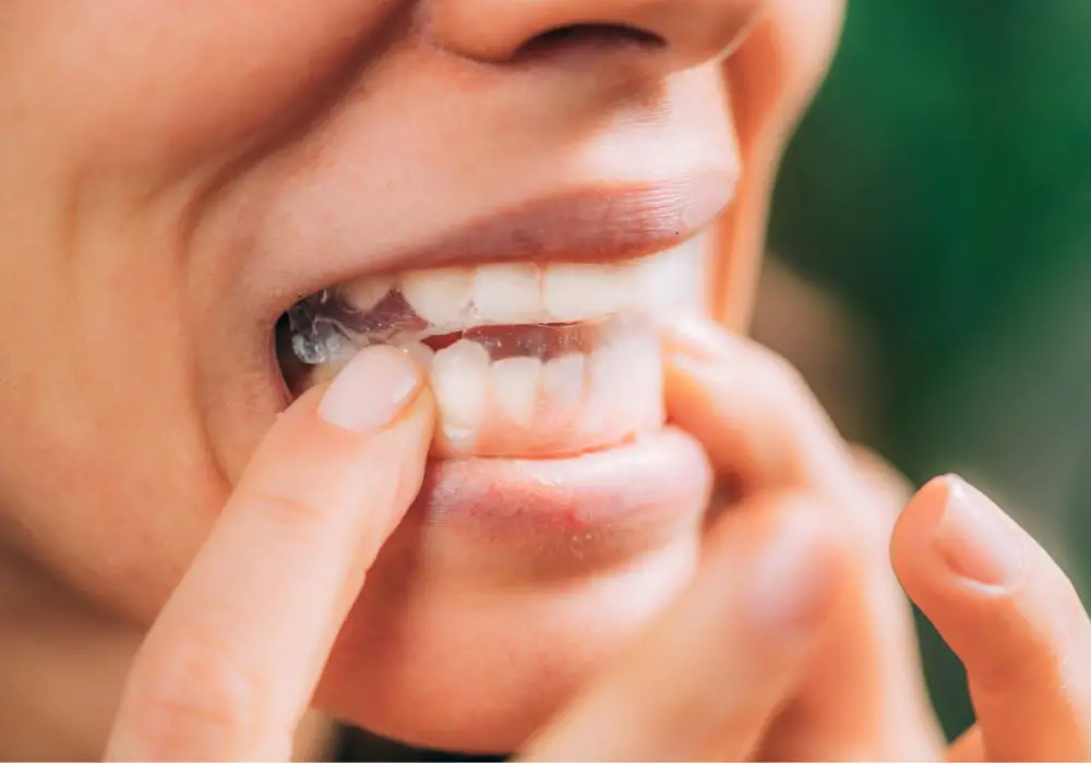 Alternatives to Teeth Whitening Strips