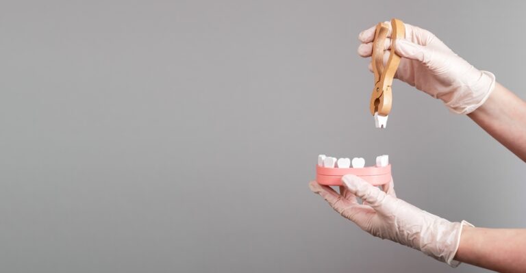 Removing Wisdom Teeth: Anesthesia-Free Options with Your Dentist