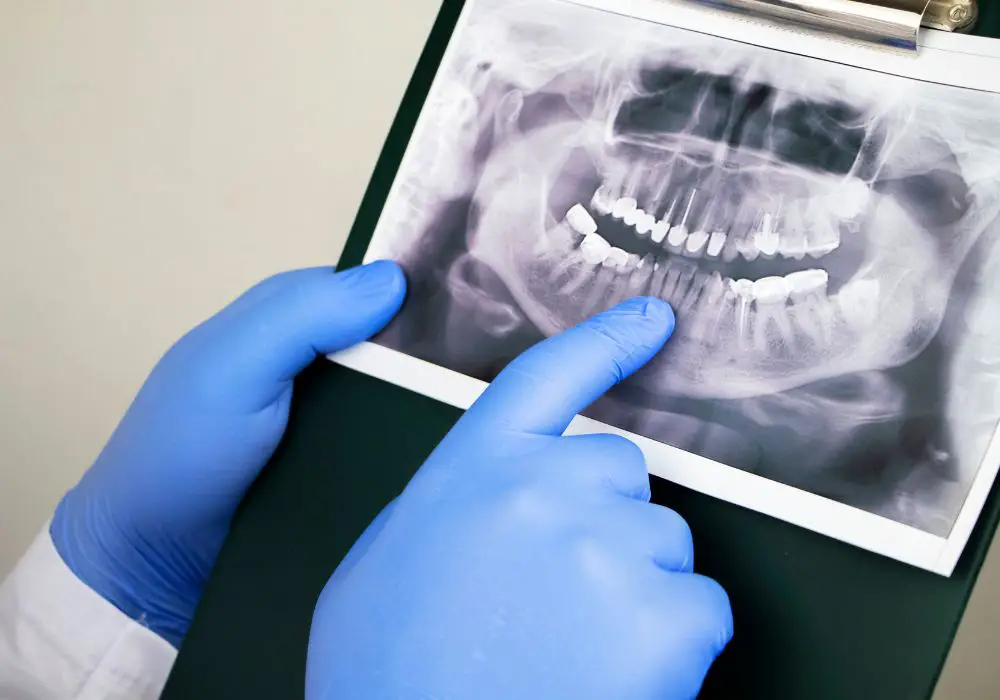 Assessing bone loss