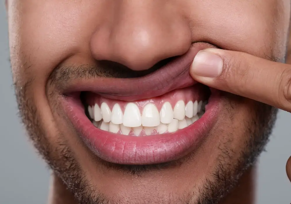 At-Home Remedies for Restoring Black Gums