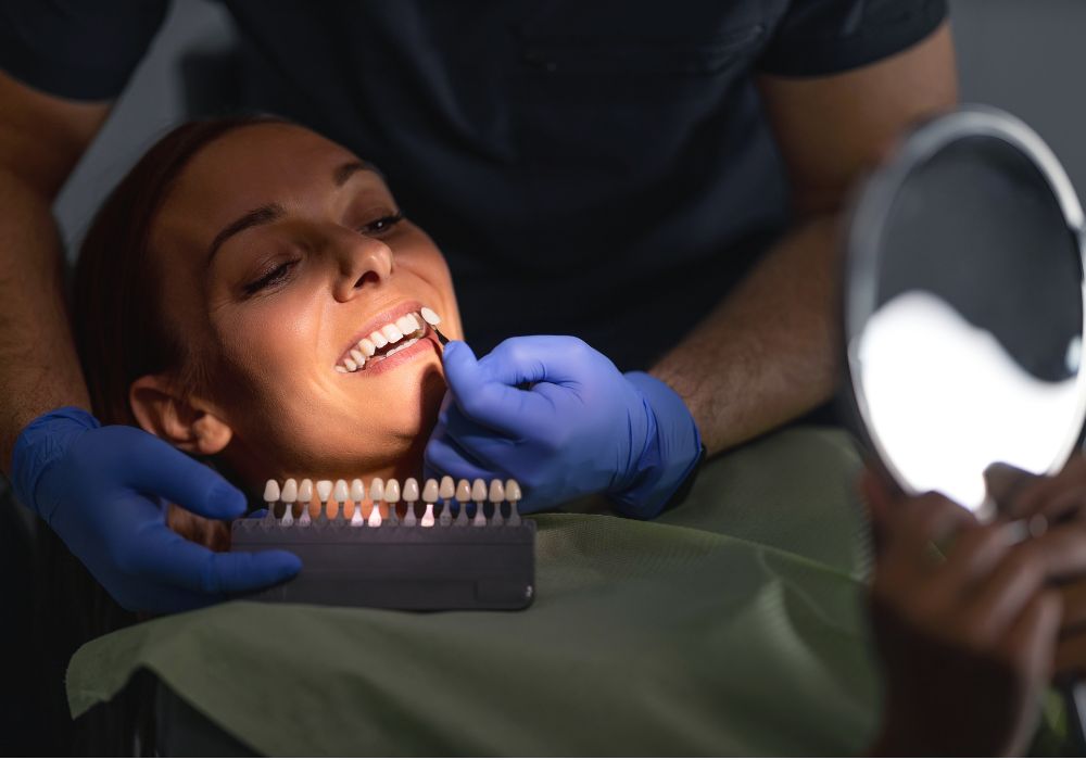 At-Home Whitening Options for Implants