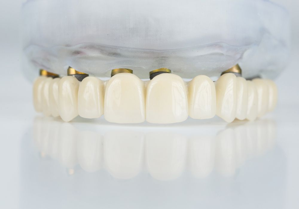 Benefits of Temporary Teeth