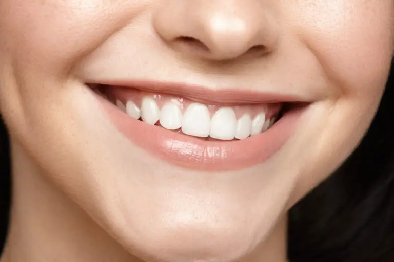 Can Gums Get Strong Again? (Treatment & Prevention tips)