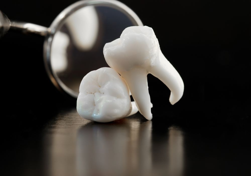 Can I Drive After Laughing Gas Wisdom Teeth? (Short Term Impairations)