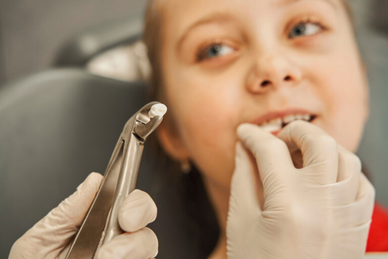 Brushing Your Teeth After a Tooth Extraction: What You Need to Know