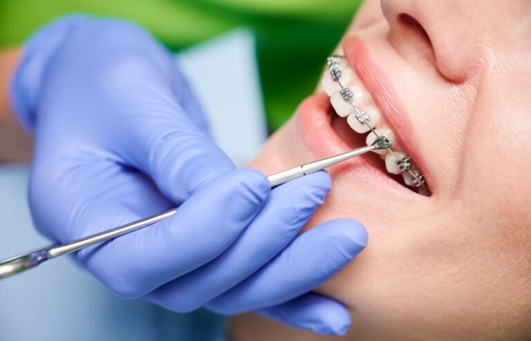 Can Orthodontists File Down Teeth? (Ultimate Guide)