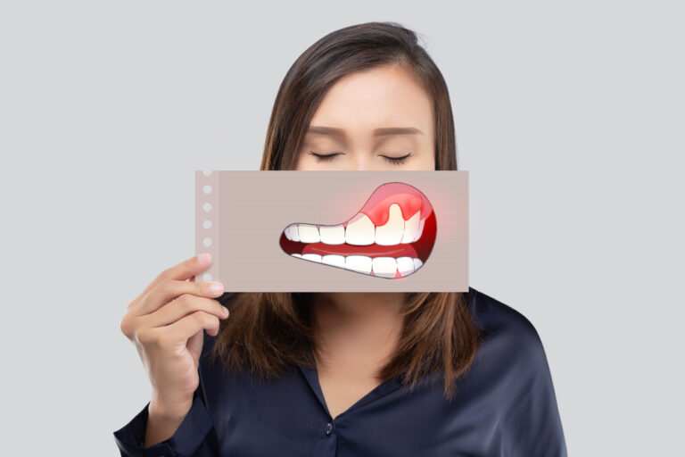 Saving Your Smile: Can Periodontal Disease Be Treated?